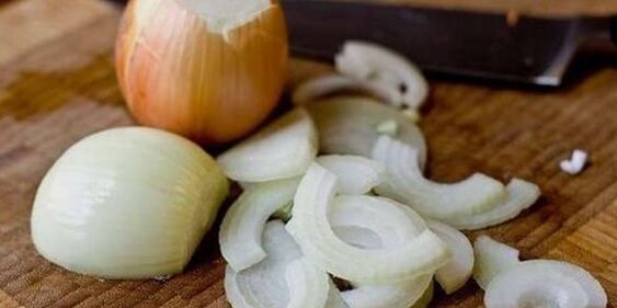 Cebola
